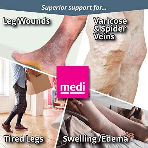 mediven Plus for Men & Women, 30-40 mmHg ? Open Toe, Knee High Compression Socks with Silicone Top Band , III-Extra-Wide-Petite, Black