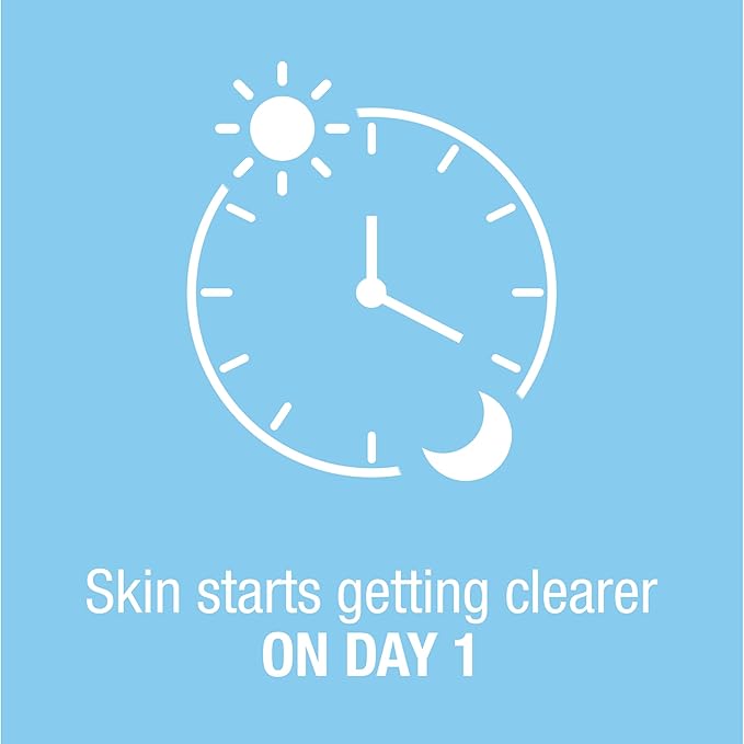 Neutrogena On-The-Spot Acne Spot Treatment Cream with 2.5% Benzoyl Peroxide, Gentle Face Blemish Medicine for Acne-Prone Skin, Vanishing Formula, Clinically Proven Day-1 Results, 0.75-Ounce Tube