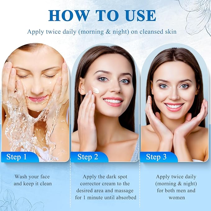 Dark Spot Remover for Face and Body, Dark Spot Corrector, Age Spot Sun Spot Freckles Dark Spot Remover, Melasma Treatment for Face, Advanced Skin Care Cream for Women and Men