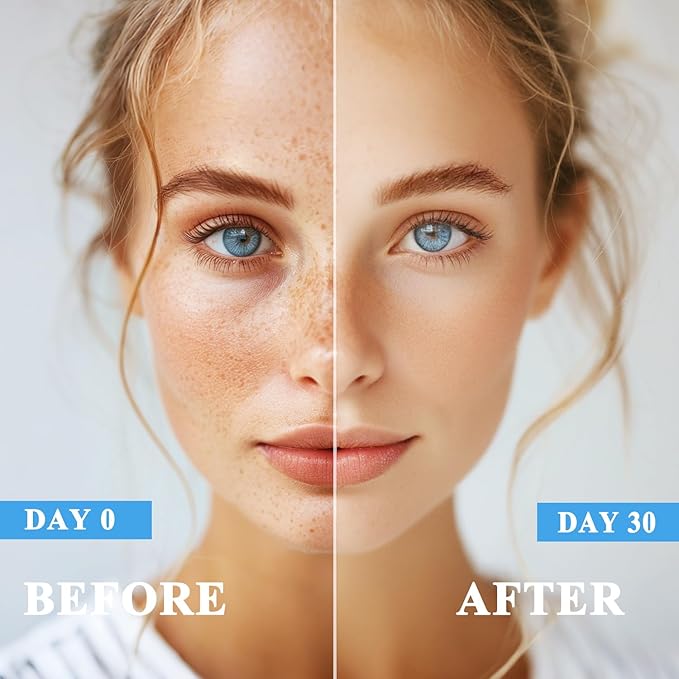 Dark Spot Remover for Face and Body, Dark Spot Corrector, Age Spot Sun Spot Freckles Dark Spot Remover, Melasma Treatment for Face, Advanced Skin Care Cream for Women and Men