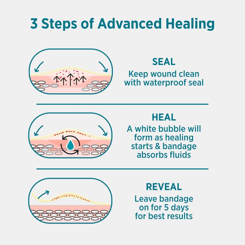 BAND-AID Brand Pro Heal 5 Day Protect, Ultra-Thin Hydrocolloid for Advanced Healing, 100% Waterproof First Aid Adhesive Bandages Provide Less Scarring Than Uncovered Wound, Assorted Sizes, 14 Count