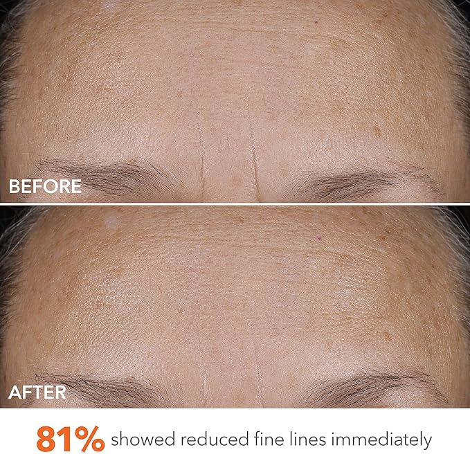 Dr Dennis Gross DermInfusions Blur + Repair Cream, Instantly Blurs Fine Lines, Smooths Skin with Satin-Matte Finish, Visibly Plumps & Firms & Improves Skin Elasticity, 0.67 Fl Oz